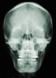 MRI